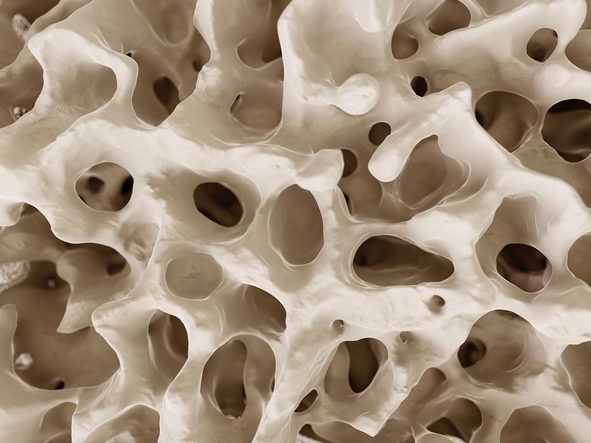 Understanding Osteoporosis: Causes, Risks & Natural Ways to Strengthen Your Bones